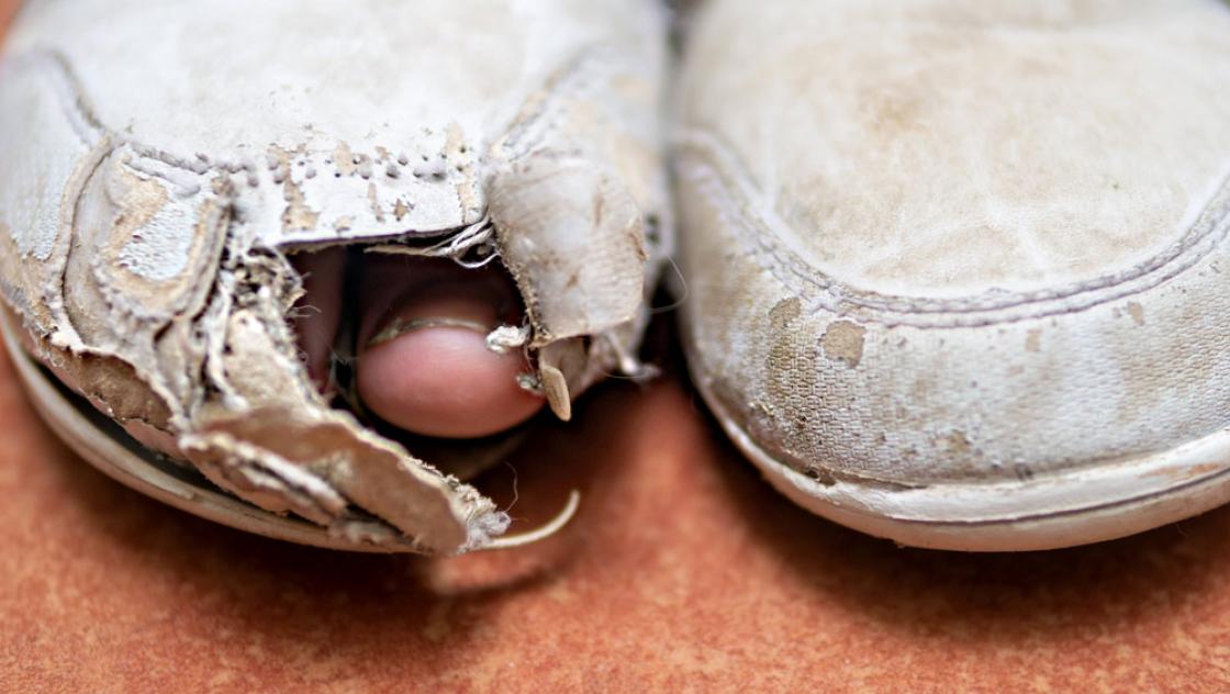 Zeh schaut aus kaputtem Sportschuh (IMAGO / CHROMORANGE) 